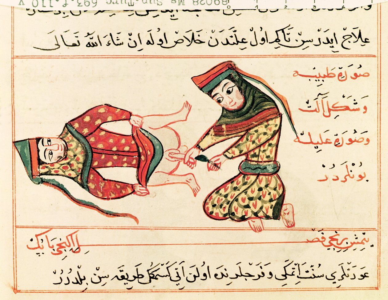 Ms Sup Turc 693 fol.110v Hebamme operiert an einem Hermaphroditen, 1466 von Charaf ed Din