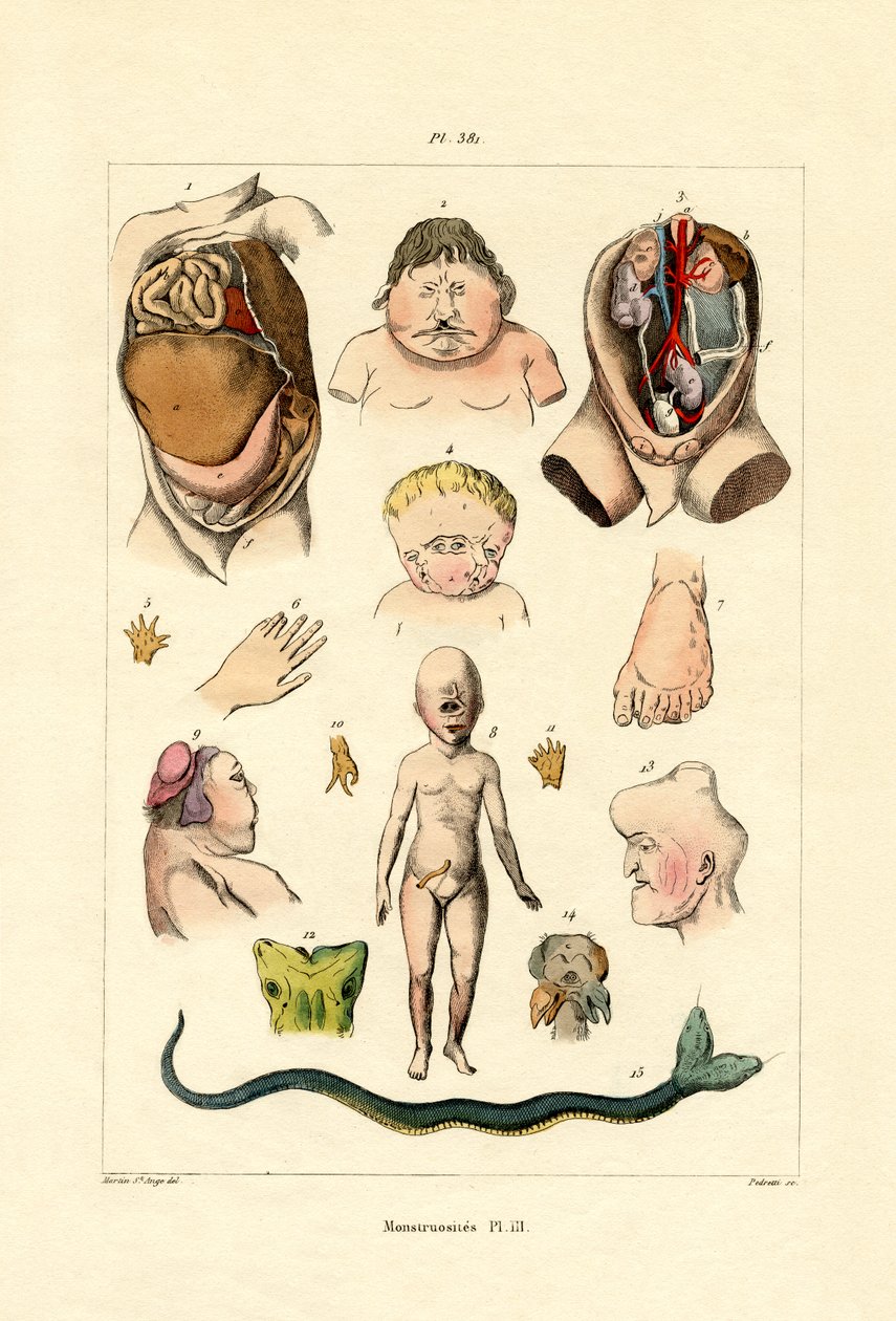Freak von French School