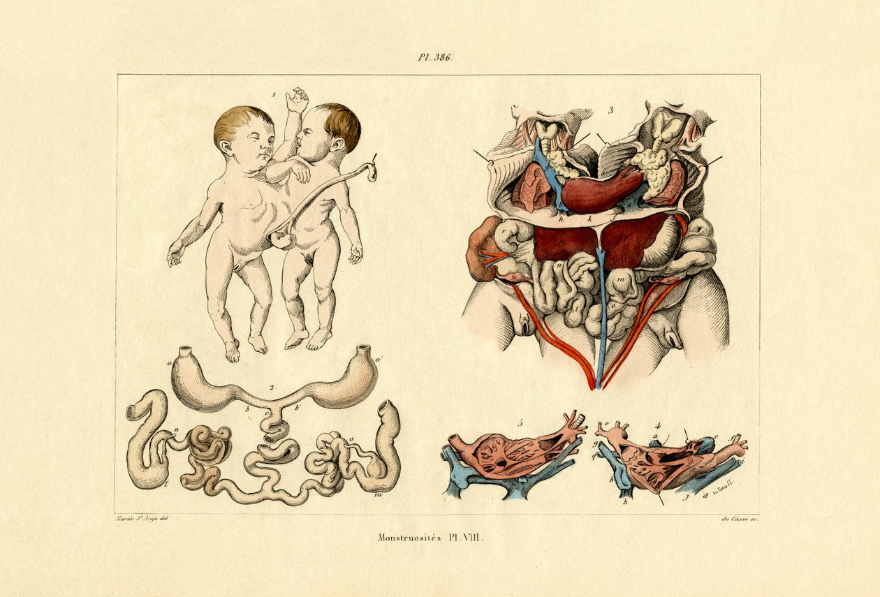 Freak von French School