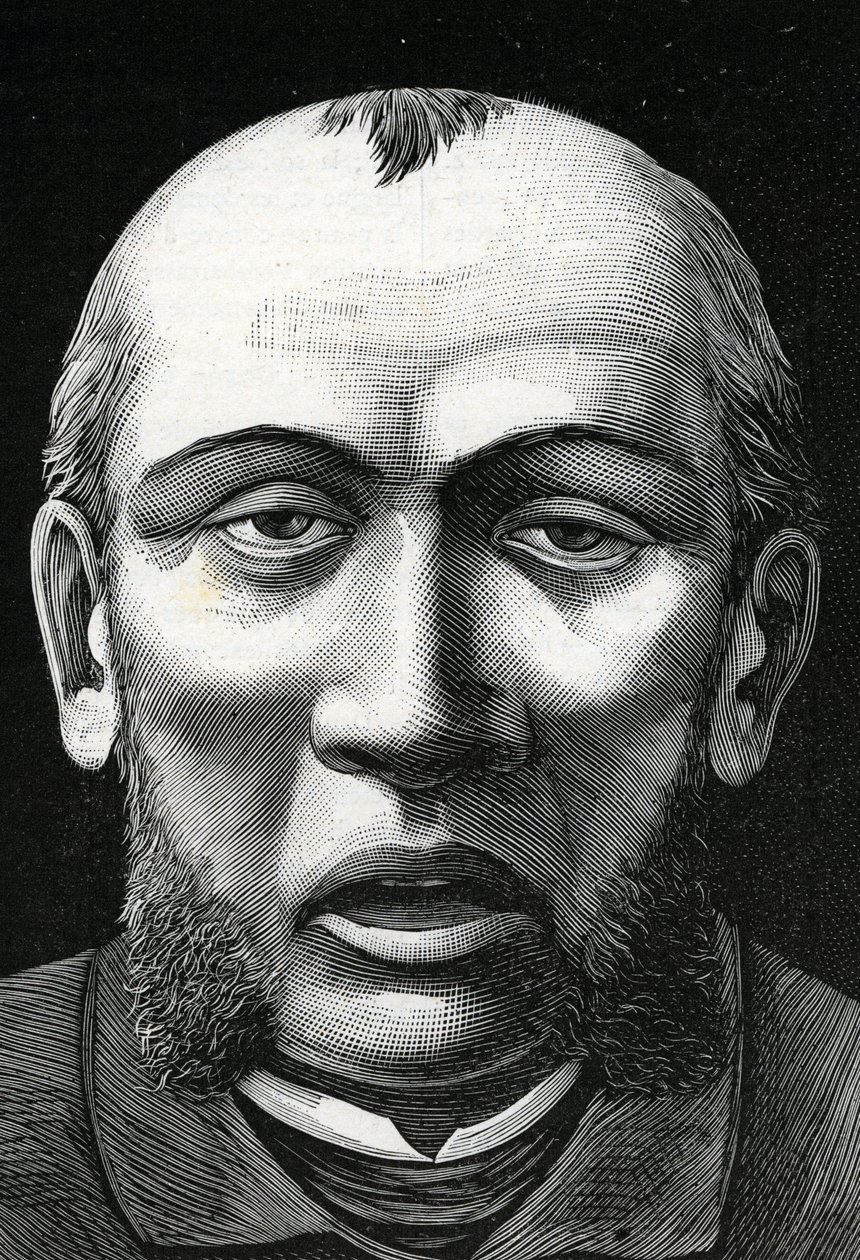 Patient mit Gehirnerweichung (Gravur) 1888 von French School