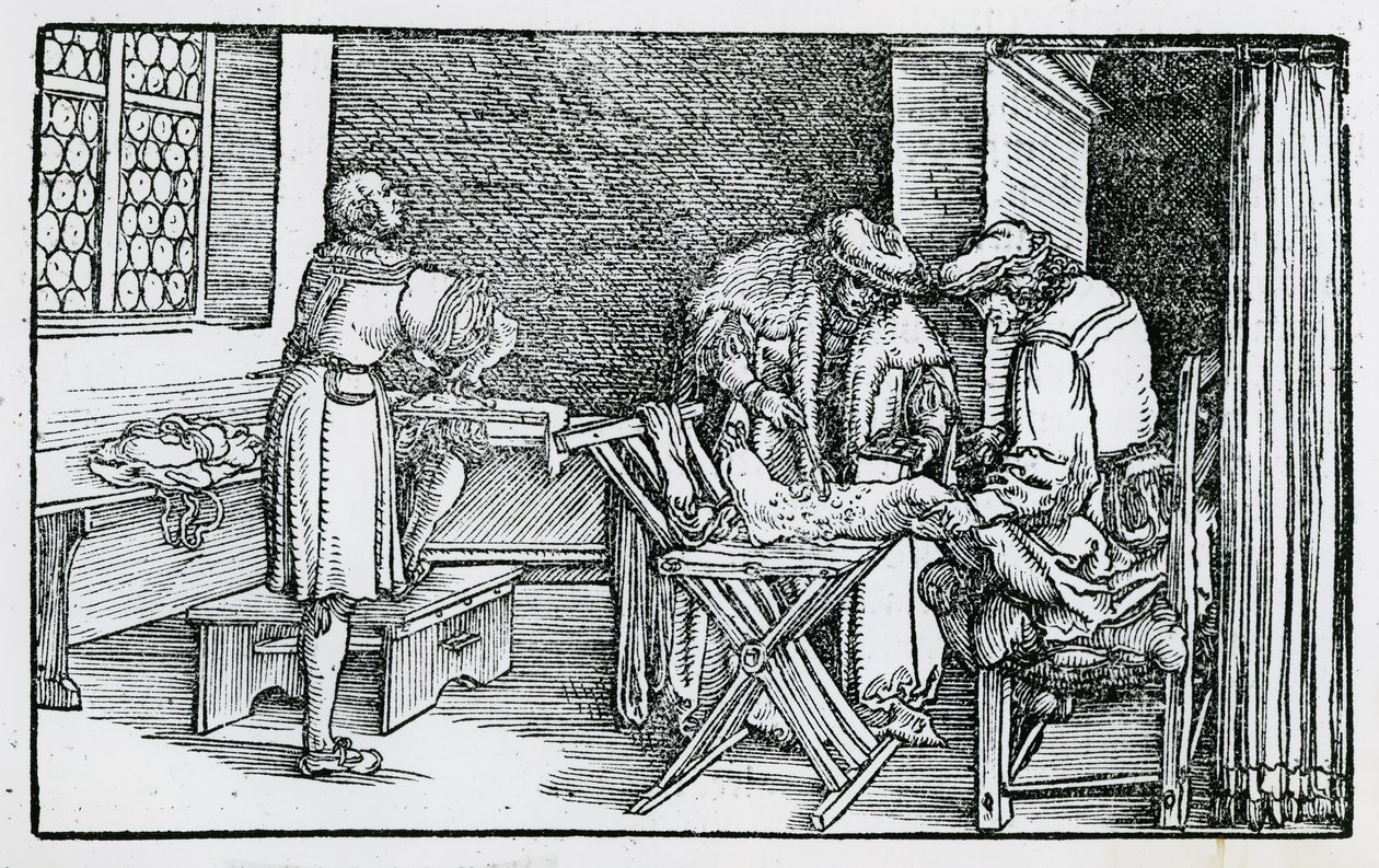 Die Behandlung eines gangränösen Beins von German School