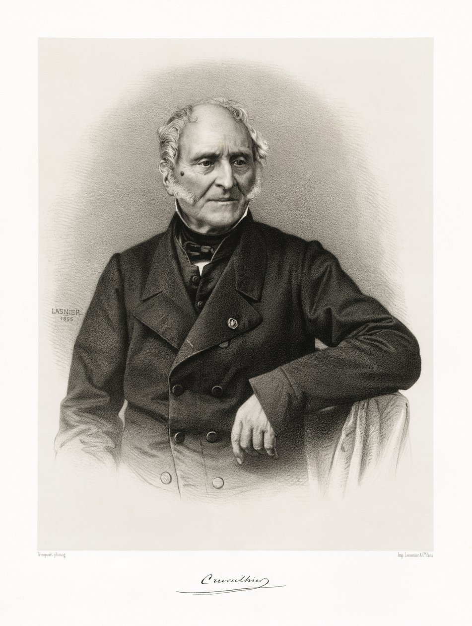 Jean Cruveilhier von Lasnier