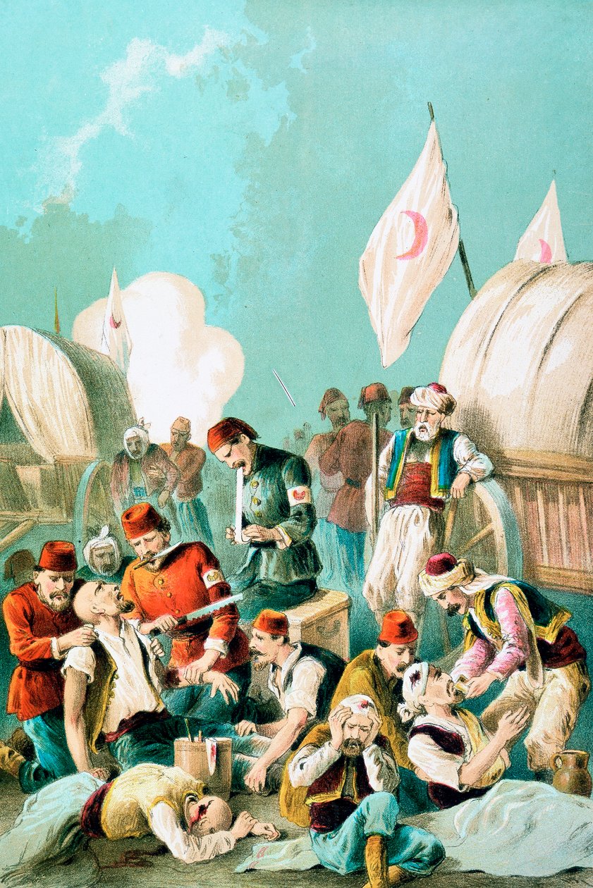 Arm wird ohne Betäubung amputiert, Russisch-Türkischer Krieg, 1877 von Unbekannt