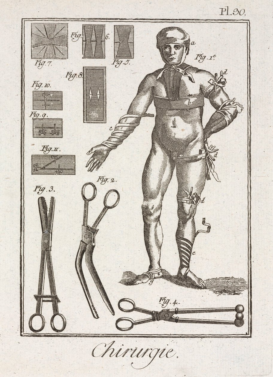 Ausrüstung, frühneuzeitliche Verbandstechnik an einer menschlichen Figur von Unbekannt