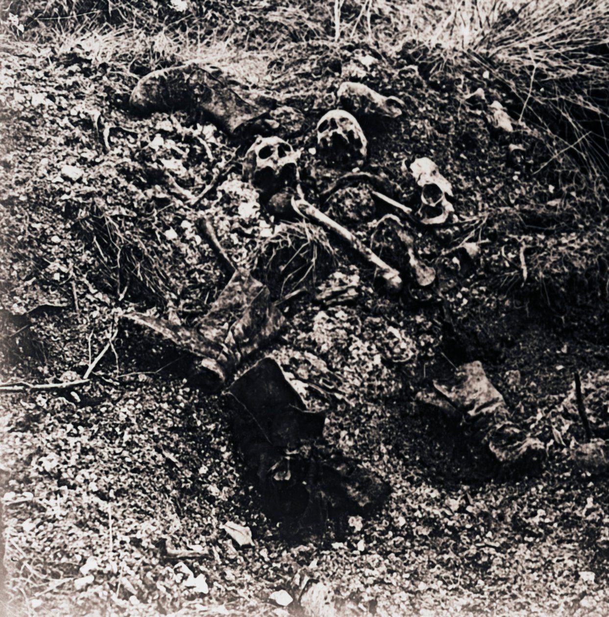 Menschliche Überreste, ca. 1914-1918 von Unbekannt