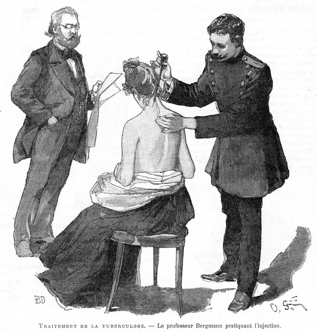 Professor Bergmann injiziert einem Tuberkulosepatienten, 1891 von Unbekannt