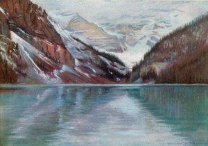 Lake Louise, der See in den Wolken