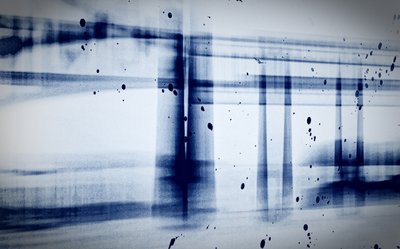 Schnee (Röntgenbild) von Alex Caminker