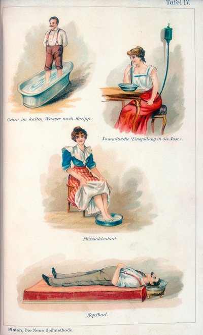 Hydrotherapie-Behandlungen, ca. 1902 von Unbekannt