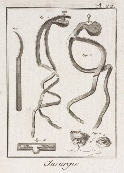 Ausrüstung, frühneuzeitliche Augenchirurgie von Unbekannt