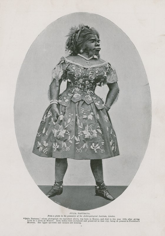 Julia Pastrana von English Photographer