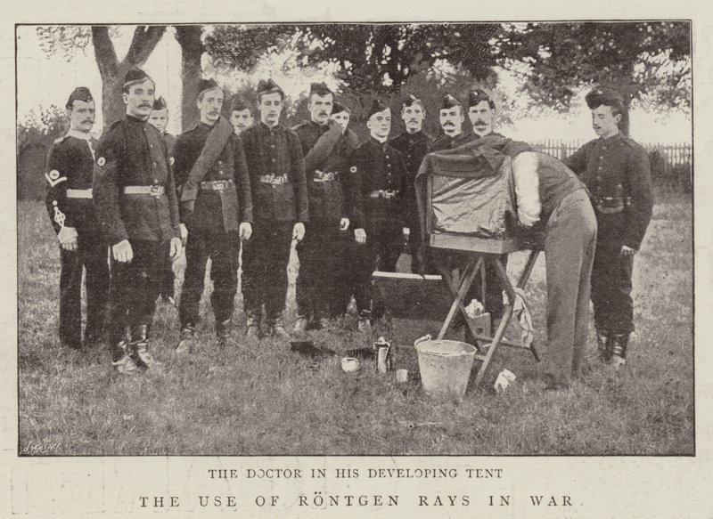 Die Verwendung von Röntgenstrahlen im Krieg von English Photographer