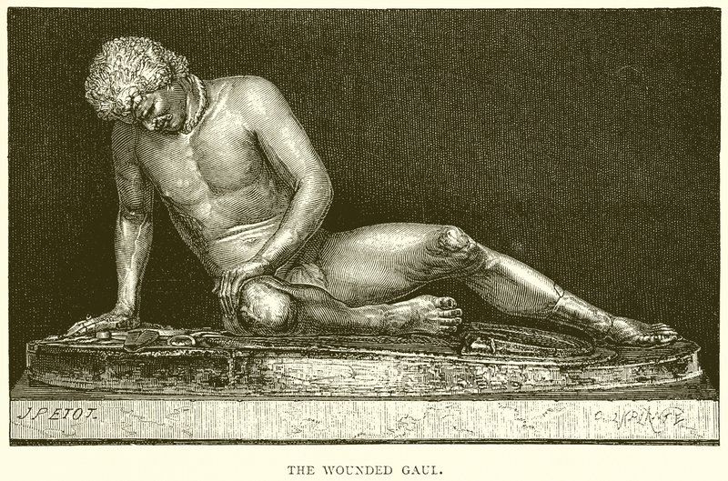 Der verwundete Gallier von English School