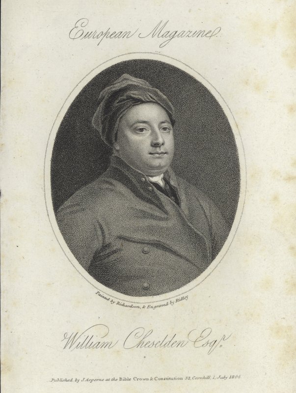 William Cheselden von English School